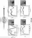 Fig. 80 - Wireless and noninvasive epidermal electronics