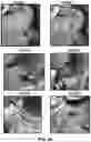 Fig. 84 - Wireless and noninvasive epidermal electronics