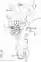 Fig. 21 - Radiation mitigation system for use with a surgical frame