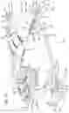 Fig. 28 - Radiation mitigation system for use with a surgical frame
