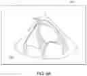 Fig. 11 - Tablet ultrasound system
