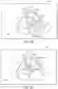 Fig. 12 - Tablet ultrasound system