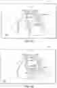 Fig. 13 - Tablet ultrasound system