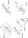 Fig. 05 - SINGLE-INSERTION, MULTIPLE SAMPLING BIOPSY DEVICE WITH LINEAR DRIVE