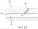 Fig. 10 - Apparatus and methods for sealing a vascular puncture