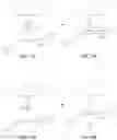 Fig. 12 - Method for intra-abdominally moving an organ