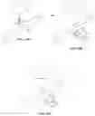 Fig. 14 - Method for intra-abdominally moving an organ