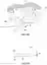Fig. 15 - Method for intra-abdominally moving an organ