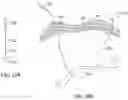 Fig. 19 - Method for intra-abdominally moving an organ