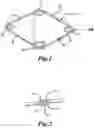 Fig. 02 - Expansion ring for eyeball tissue