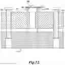 Fig. 09 - Expansion ring for eyeball tissue