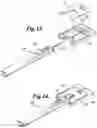Fig. 10 - Expansion ring for eyeball tissue