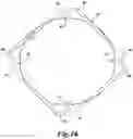 Fig. 12 - Expansion ring for eyeball tissue