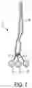 Fig. 05 - Self-assembling suture anchor assembly, surgical kit, and surgical repair method