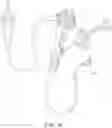 Fig. 08 - Endoscopic suture cinch