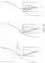 Fig. 18 - Endoscopic suture cinch