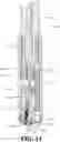 Fig. 12 - LOCKING NAIL FOR LOCKING SUTURES AND INTERVENTIONAL REMOTE SUTURE LOCKING DEVICE