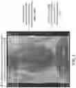 Fig. 08 - Devices and methods for effectuating percutaneous shunt procedures
