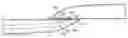 Fig. 01 - ANASTOMOSIS DEVICES