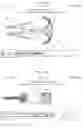 Fig. 15 - Apparatuses and Methods for Use in Surgical Vascular Anastomotic Procedures