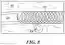 Fig. 11 - DEVICES, SYSTEMS, AND METHODS FOR MINIMALLY INVASIVE MODULATION OF ABDOMINAL TISSUE