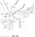 Fig. 18 - DEVICES, SYSTEMS, AND METHODS FOR MINIMALLY INVASIVE MODULATION OF ABDOMINAL TISSUE