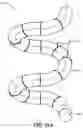 Fig. 20 - DEVICES, SYSTEMS, AND METHODS FOR MINIMALLY INVASIVE MODULATION OF ABDOMINAL TISSUE