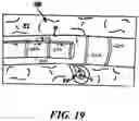 Fig. 24 - DEVICES, SYSTEMS, AND METHODS FOR MINIMALLY INVASIVE MODULATION OF ABDOMINAL TISSUE