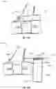 Fig. 23 - CARDIAC IMPLANTABLE ELECTRONIC DEVICE POCKET COMPRESSION APPARATUS AND METHOD OF MITIGATING LOCALIZED BLEEDING USING SAME