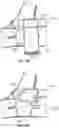 Fig. 24 - CARDIAC IMPLANTABLE ELECTRONIC DEVICE POCKET COMPRESSION APPARATUS AND METHOD OF MITIGATING LOCALIZED BLEEDING USING SAME