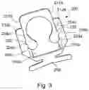 Fig. 04 - INDEXABLE FEMORAL NECK RESECTION GUIDE