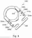 Fig. 05 - INDEXABLE FEMORAL NECK RESECTION GUIDE