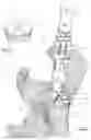 Fig. 08 - Surgical bone preparation instrument and assembly comprising such an instrument