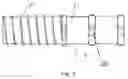 Fig. 05 - STONE EXTRACTION BASKET AND DOUBLE LUMEN END CAP FOR STONE EXTRACTION BASKET