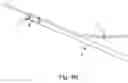 Fig. 07 - STONE EXTRACTION BASKET AND DOUBLE LUMEN END CAP FOR STONE EXTRACTION BASKET