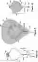 Fig. 05 - RETRIEVAL DEVICE