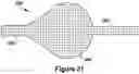 Fig. 11 - RETRIEVAL DEVICE