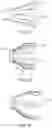 Fig. 10 - DEVICES AND METHODS FOR ASPIRATION OF THROMBUS