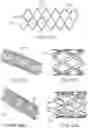 Fig. 23 - DEVICES AND METHODS FOR ASPIRATION OF THROMBUS