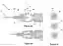 Fig. 08 - Treatment of ischaemia