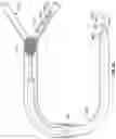 Fig. 16 - Clot removal methods and devices with multiple independently controllable elements