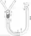 Fig. 18 - Clot removal methods and devices with multiple independently controllable elements