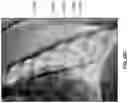 Fig. 41 - Clot removal methods and devices with multiple independently controllable elements