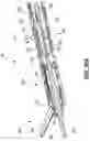 Fig. 29 - ULTRASONIC SURGICAL INSTRUMENT WITH A MULTIPLANAR ARTICULATION JOINT