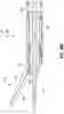 Fig. 32 - ULTRASONIC SURGICAL INSTRUMENT WITH A MULTIPLANAR ARTICULATION JOINT