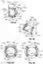 Fig. 58 - ULTRASONIC SURGICAL INSTRUMENT WITH A MULTIPLANAR ARTICULATION JOINT