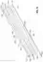 Fig. 11 - SURGICAL INSTRUMENT WITH CLAMPING SENSOR FEEDBACK