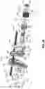 Fig. 30 - SURGICAL INSTRUMENT WITH CLAMPING SENSOR FEEDBACK