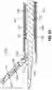 Fig. 57 - SURGICAL INSTRUMENT WITH CLAMPING SENSOR FEEDBACK