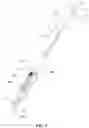 Fig. 02 - DIRECT-VISION ABORTION UTERINE CURETTAGE DEVICE AND SYSTEM